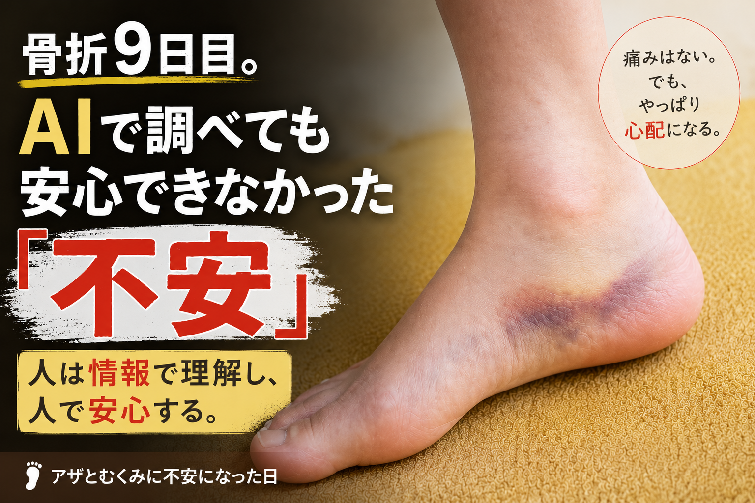 骨折9日目の右足。くるぶし下にアザとむくみが見られ、不安になった時の記録